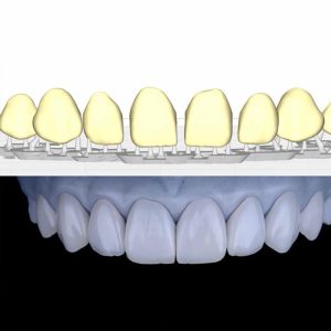Guía de protocolos de cementación e implantes de Ricardo Omi Estudio